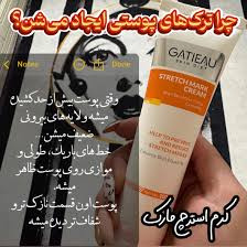 کرم رفع ترک های پوستی ناشی از بارداری وچاقی و لاغری گاتیو ایتالیا 100 میل